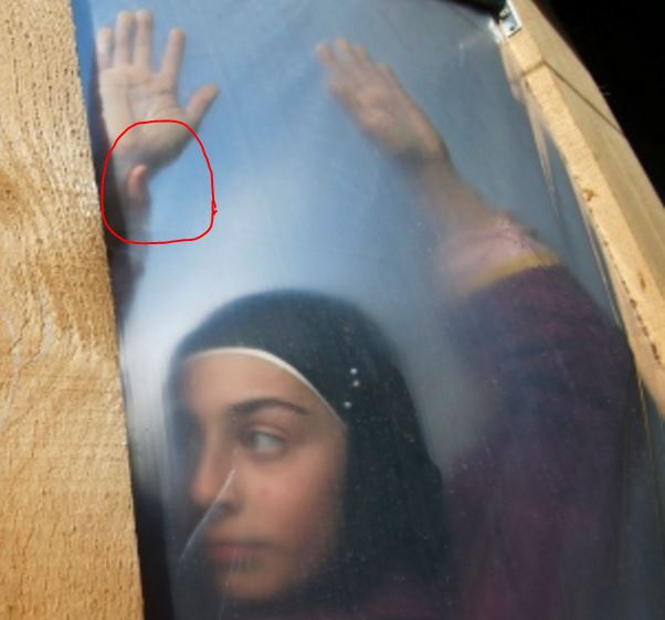 iMediaEthics circled the random thumb shown in the Reuters photo.